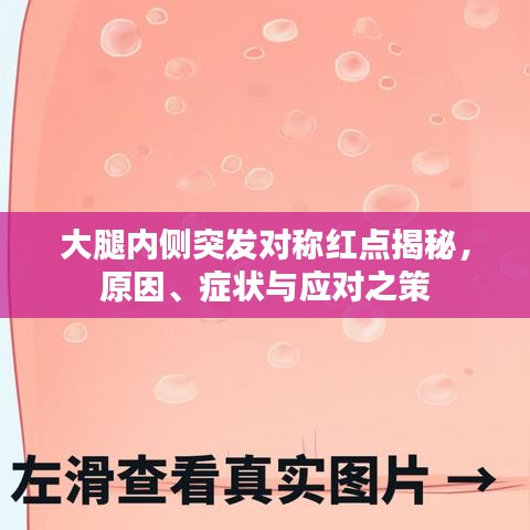 大腿內(nèi)側(cè)突發(fā)對稱紅點揭秘，原因、癥狀與應對之策
