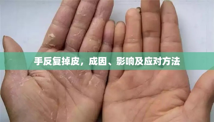 手反復掉皮，成因、影響及應(yīng)對方法