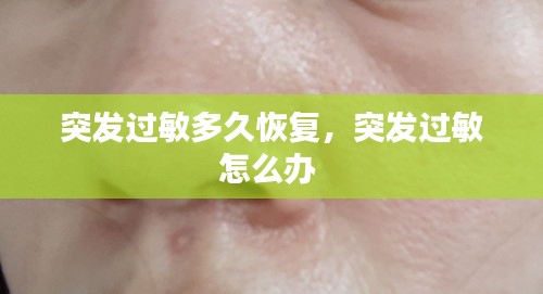 突發(fā)過敏多久恢復(fù)，突發(fā)過敏怎么辦 