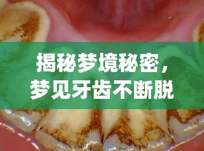 揭秘夢境秘密，夢見牙齒不斷脫落的背后含義
