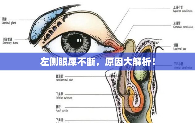 左側(cè)眼屎不斷，原因大解析！