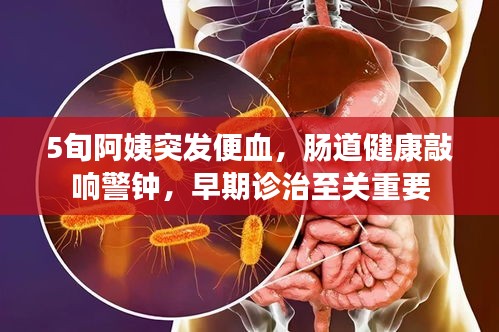 5旬阿姨突發(fā)便血，腸道健康敲響警鐘，早期診治至關重要
