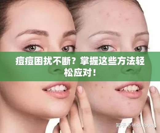 痘痘困擾不斷？掌握這些方法輕松應對！