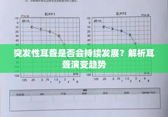 突發(fā)性耳聾是否會(huì)持續(xù)發(fā)展？解析耳聾演變趨勢(shì)
