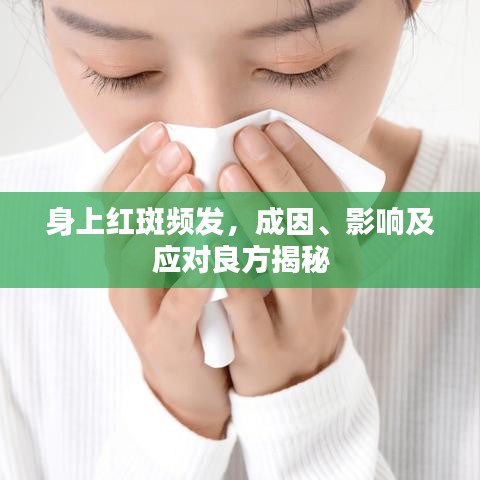 身上紅斑頻發(fā)，成因、影響及應(yīng)對(duì)良方揭秘