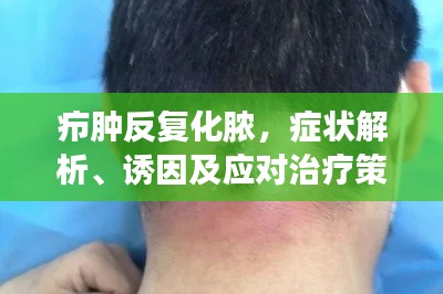 癤腫反復(fù)化膿，癥狀解析、誘因及應(yīng)對(duì)治療策略
